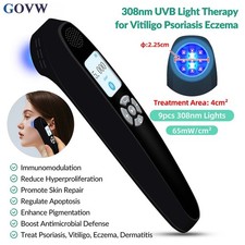308nm UVB Light Therapy Equipment 9 Diodes for Small Area Skin Care at Home Use