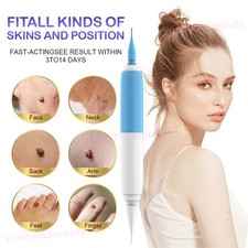 2in1 Auto Skin Tag Painless Skin Tag Mole Wart Removal Kit Bands Remover Natural