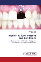 Implant Failure: Reasons And Conditions Akanksha Singh (U. A.) Taschenbuch 2025