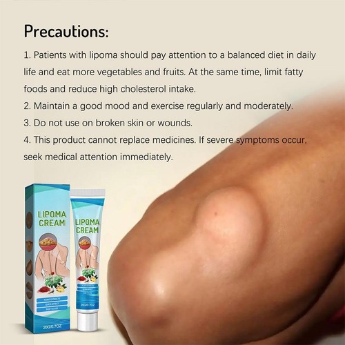 US-Lipoma Soothing Cream Instant Ointment Relieving DiscomfortFat Agglomera best - Picture 5 of 12
