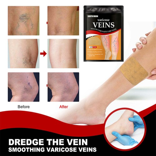 12pc/pack Vein Health Patch Relieves Varicose Feet Vessel Blockage Cold