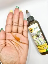 Hair Growth -anti dandruff oil