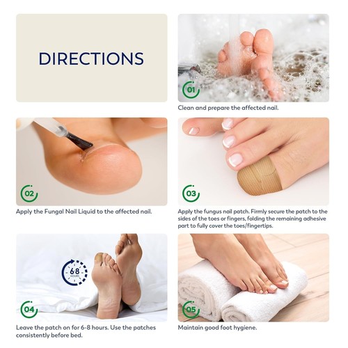 Toenail Fungus Treatment – 21 Hydrogel Patches for Overnight Nail Repair - Picture 9 of 9