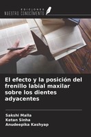 Sakshi Malla (U. A.) | El Efecto Y La PosicióN Del Frenillo Labial Maxilar...
