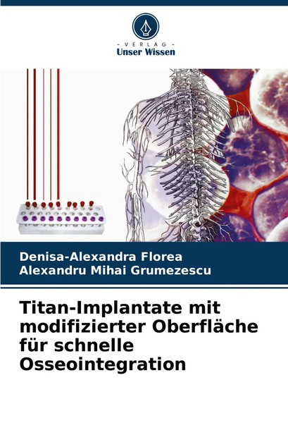 Denisa-Alexandra Florea (U. A.) | Titan-Implantate Mit Modifizierter...-image