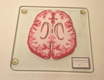 Brain Slide Coaster single Neuroanatomy Autopsy Pathology 4'' pink histology ht