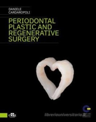 PERIODONTAL PLASTIC & REGENERATIVE SURGE by CARDAROPOLI, DANIELE Hardback