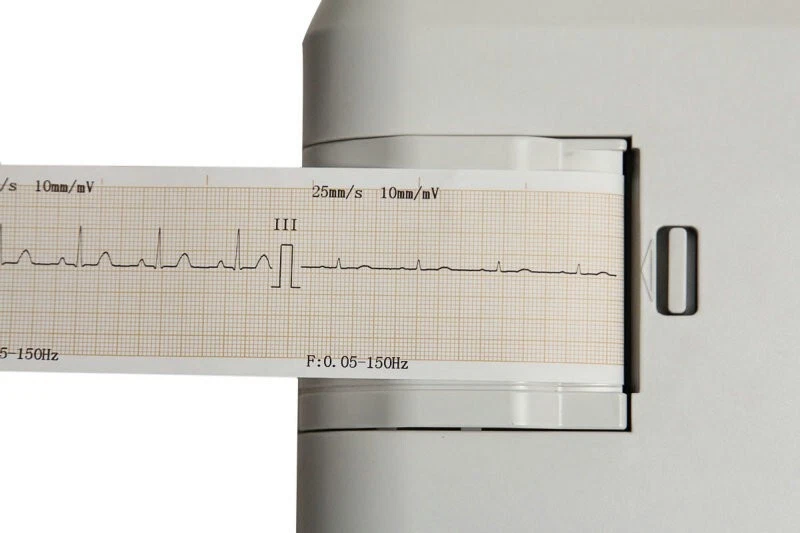 CONTEC ECG EKG Electrocardiograph Digital 1 Channel 12 lead Machine ECG100G FDA - Image 2 of 4