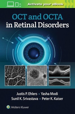 OCT and OCTA in Retinal Disorders by Justis P. Ehlers (English) Paperback Book