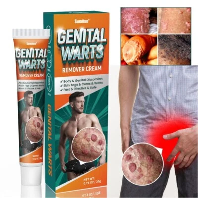 SUMIFUN 20g Skin Tag Male Antibacterial Ointment Private Area Warts Removal Cream