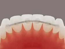 Dead Soft Flat Ortho Lingual Retainer Wire - 60" - Spool/ Roll/ Strips 