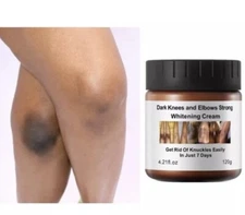 New Strong Whitening Cream For Removing Dark Knuckle Finger Elbow and Knee USA