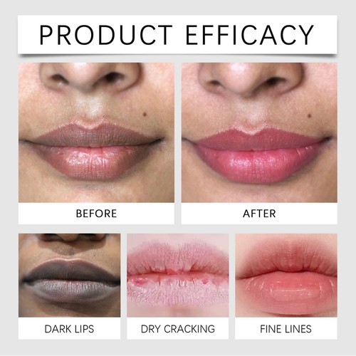 Lip Lightening Cream for Dark Lips|Lip Lightener for Smokers and Non-Smokers - Foto 4 di 9