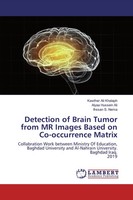 Detection Of Brain Tumor From MR Images Based On Co-Occurrence Matrix Buch 2019