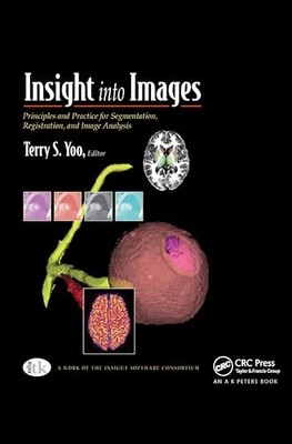 Insight into Images: Principles and Practice for Segmentation, Registration, an