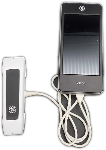 GE Vscan Extend Portable Ultrasound System