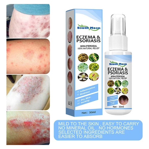 30ml Skin Psoriasis Spray Natural Herb Eczema Treatment Spray Itch Relief New - Picture 6 of 19