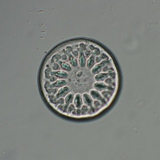 Vintage Microscope Slide. Plates of Asterolampra Diatoms