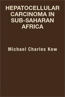 #ad #ad Hepatocellular Carcinoma in Sub Saharan Africa Paperback or Softback $22.11