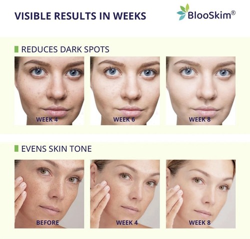 Turmeric Kojic Acid Cleansing Pads: Turmeric Pads for Face Dark Spots - Exfoliat - Picture 7 of 8