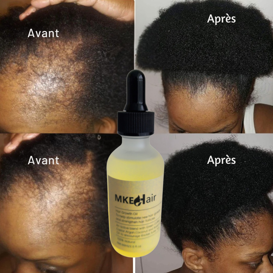 Huile Miracle Cheveux Denses MKE HAIR sérum pousse cheveux et volume pour cuir chevelu sensible