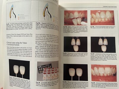 QDT 1992 ~ Quintessence Of Dental Technology ~ Volume 15 ~ OOP | eBay
