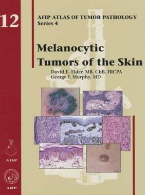 Melanocytic Tumors of the Skin by David E. Elder: Used