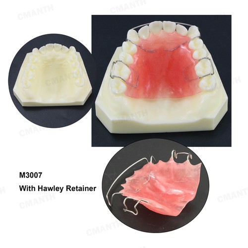 Modello dentale Hawley la struttura del fermo dentista insegna igiene orale modello - Foto 2 di 8
