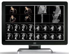 Barco Coronis Fusion MDCC-6430 (K9301635B) 6MP LED Color Radiology Monitor
