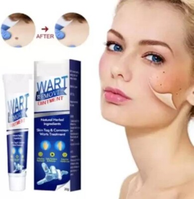 Cure18 Wart Remover Cream, Massa Removal Cream Pack of 1 of 100G (100 g)