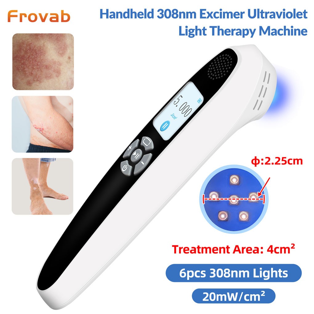 ALTRA 308nm Eccimero Uvb Luce Terapia Uso Domestico Dispositivo Fototerapia per Malattie della Pelle 