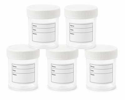Probenbehälter Gläser 60 ml mit Patientenetikett und Volumenmarkern je 5