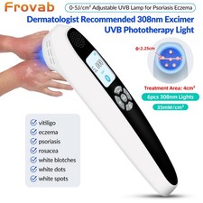308nm UVB Phototherapy Light Device for Home Skin Treatment  Blue Light Therapy
