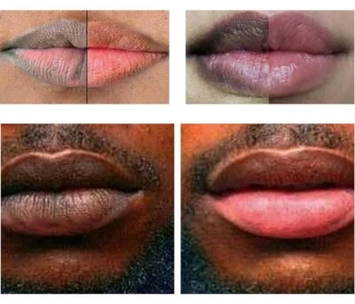 NAXR 2pcs Lip Lightening Bleaching Cream Effective Treatment Remove Dark Smoker Balm