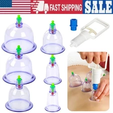 Body Scraping Massage Smart Electric Vacuum Cupping Heating Suction Cup Device