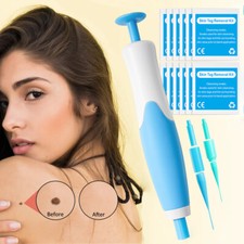 2in1 Painless Auto Mole Wart Removal Skin Tag 40x Rubber Bands 10x Alcohol Pad