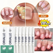 3-15X Orville Nail Fungus Pen Anti Fungus Infection Nail Care Repair Pen Toenail