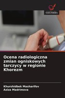 Khurshidbek Masharifov (U. A.) | Ocena Radiologiczna Zmian Ogniskowych...
