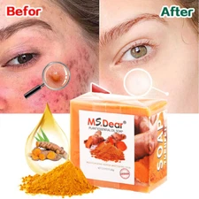 1-3X Tumeric Soap Skin Whitening Dark Spots lightening Acne Brightening Turmeric