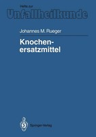Johannes M. Rueger | Knochenersatzmittel | Taschenbuch | Deutsch (1992) | Xiv