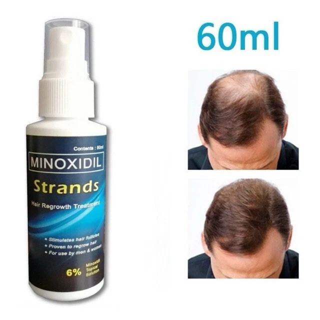 Спрей для мужчин и женщин MAXIMUM FORCE Hair Grower Topical Solution 60 мл - Изображение 2 из 4