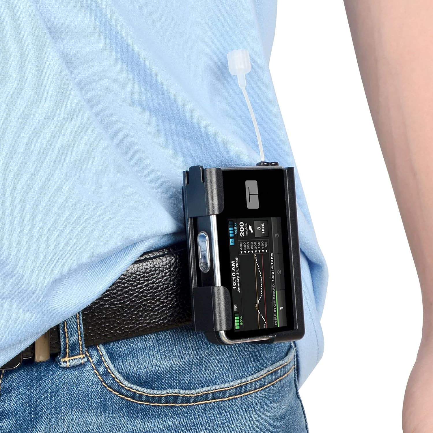 Iguerburn 360° Rotating Case for Tandem Tslim X2, Insulin Pump Holder for T Slim