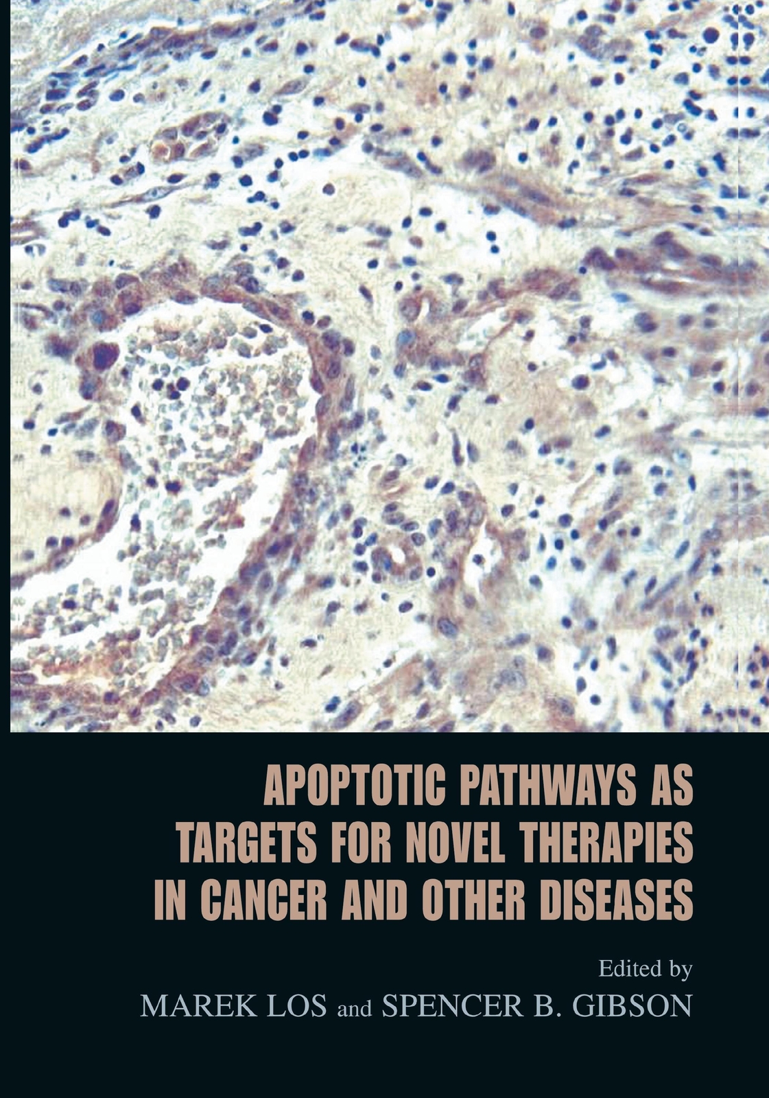Thumbnail - Apoptotic Pathways As Targets For Novel Therapies In Cancer And Other