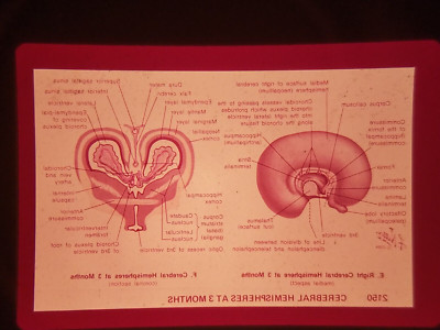 XAO09 35mm Slide Photo Vintage CEREBRAL HEMISPHERES AT 3 MONTHS