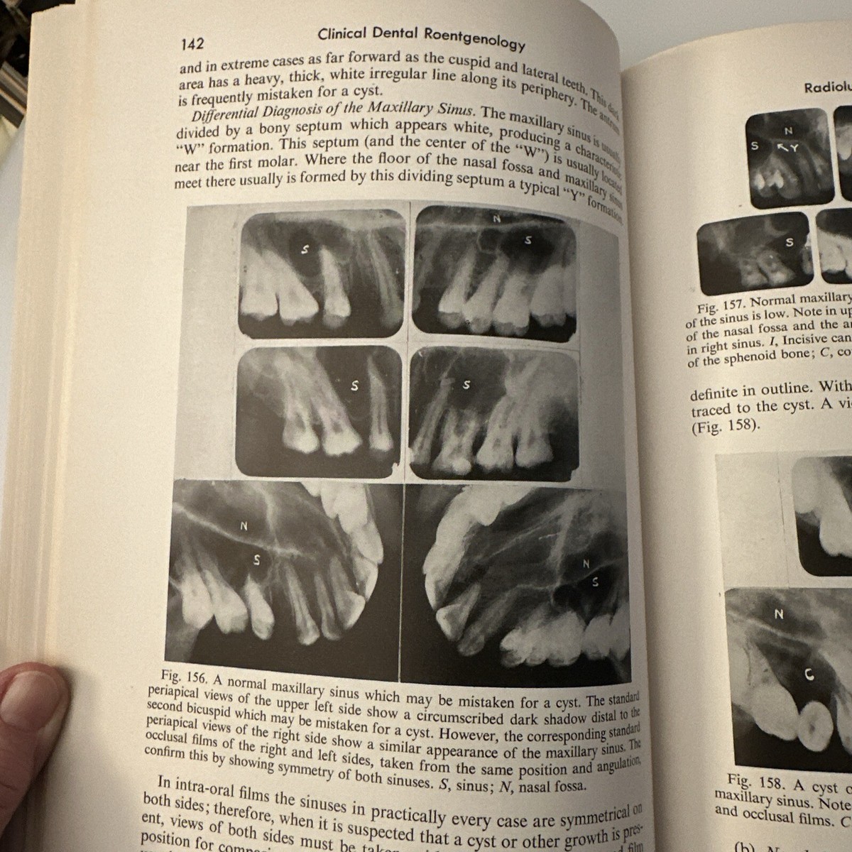 洋書 KLASSISCHE FELDEORIE OLD X-RAY BOOK Clinical Dental Roentgenology Technic 1952