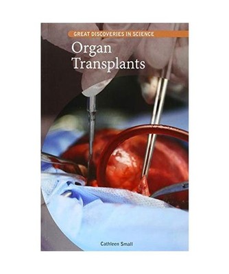 Organ Transplants, Cathleen Small