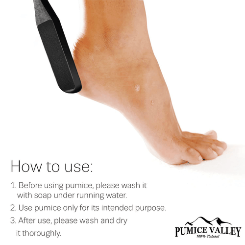 Pumice Stone Foot Scrubber Pedicure Foot File with Handle for Dry Dead Skin - Picture 5 of 7