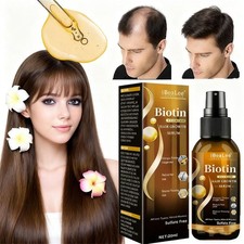 5x Biotin Hair Growth Spray Anti Hair Loss Fast Regrowth Scalp Treatment Serum