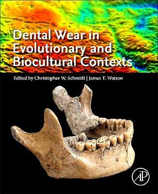 Dental Wear in Evolutionary and Biocultural Contexts Schmidt Watson Paperback