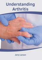 Jerry Larson | Understanding Arthritis | Buch | Englisch (2019) | Gebunden